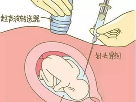 胎儿在肚子里能不能做亲子鉴定（做胎儿亲子鉴定。费用多少钱。）