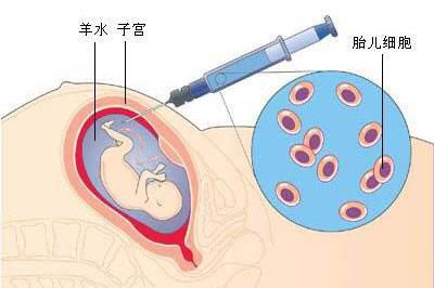 胎儿能做亲子鉴定（产前胎儿DNA鉴定怎么做？）